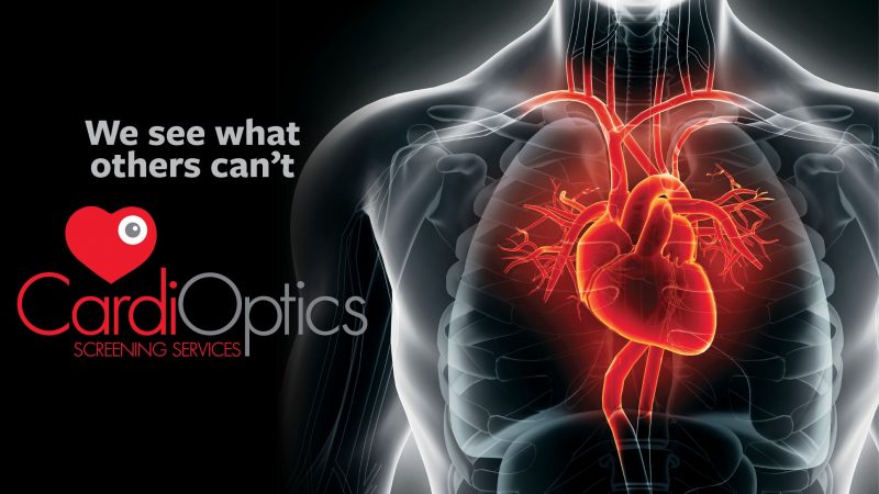 CardiOptics